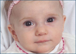 Zoloft baby story